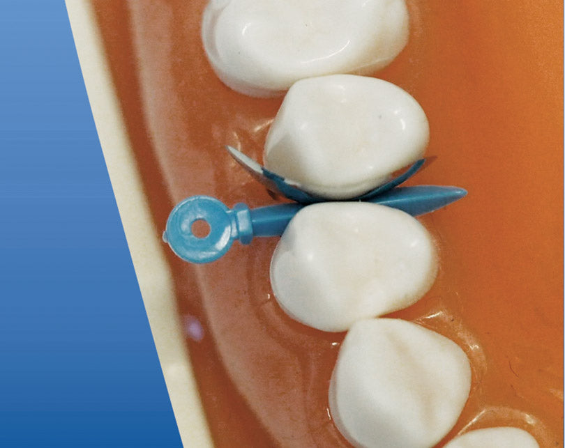 Self-Adapting Fixing Wedges