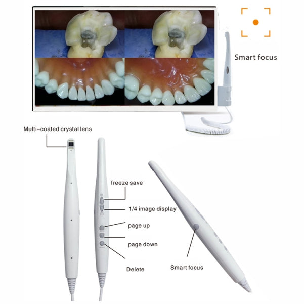 CF-988II W wireless intraoral camera with 21.5-inch Full HD monitor