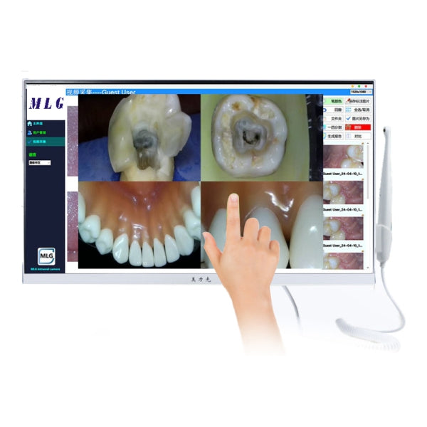 PoNy M-568 W Full HD wireless intraoral camera with touchscreen monitor