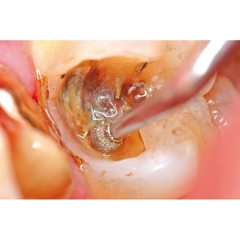 Acteon Sopro 717 First intraoral camera