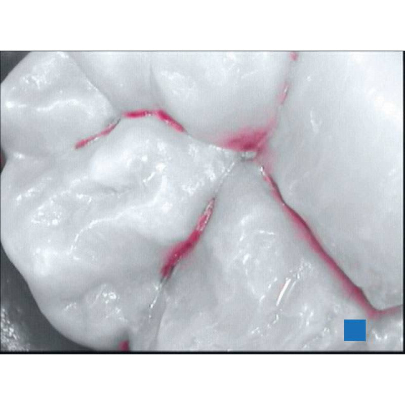 Acteon SoproCare intraoral camera