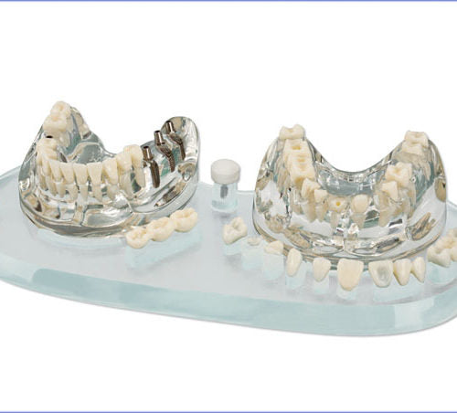 Toothbrushing Model