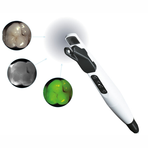 KaVo DIAGNOcam Vision Full HD intraoral camera