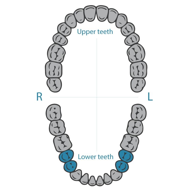 Dentech rubber dam clamp 2 for lower premolars