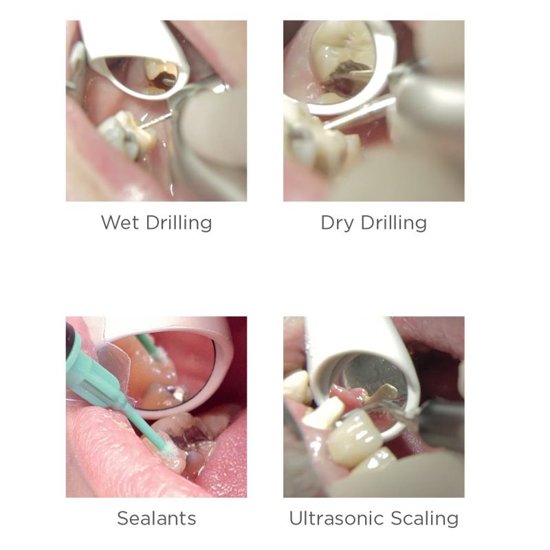 Dentsply Sirona Purevac HVE evacuation system kit