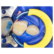 Polydentia myJunior pediatric sectional matrix kit