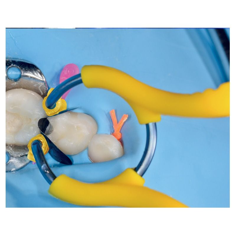 Polydentia myJunior pediatric sectional matrix kit