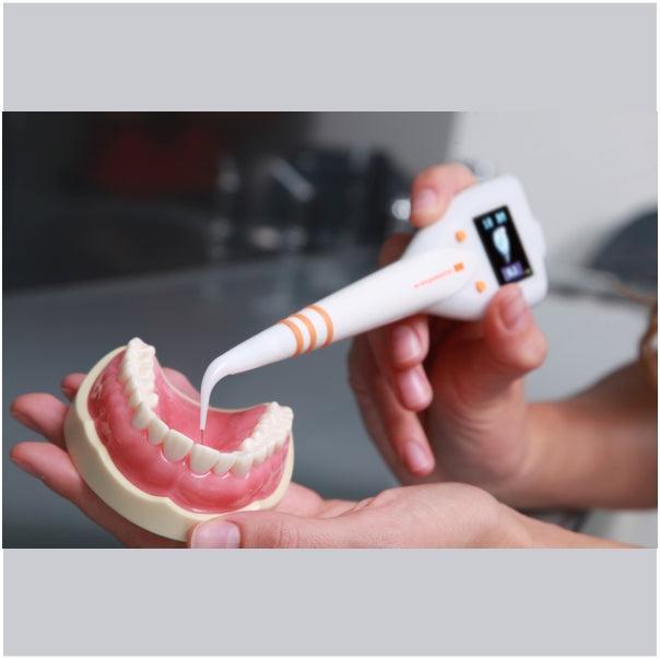Orange Dental pa-on Parometer wireless periodontal probe