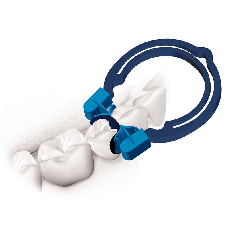Polydentia myQuickmat Forte sectional matrix kit