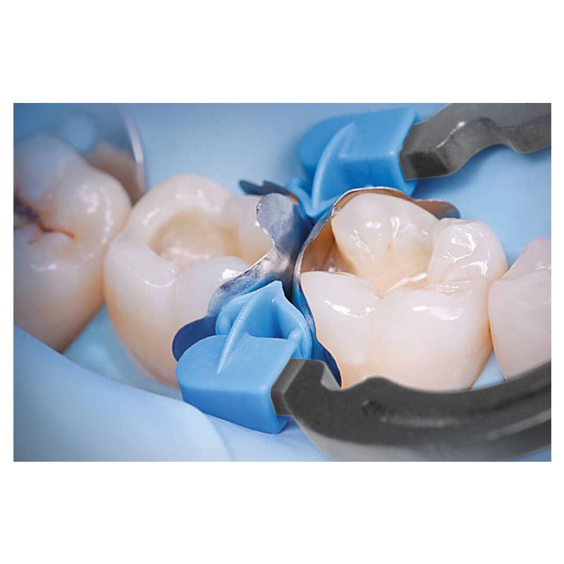 Polydentia QuickmatFIT Premolar anatomical sectional matrices, 100 pieces
