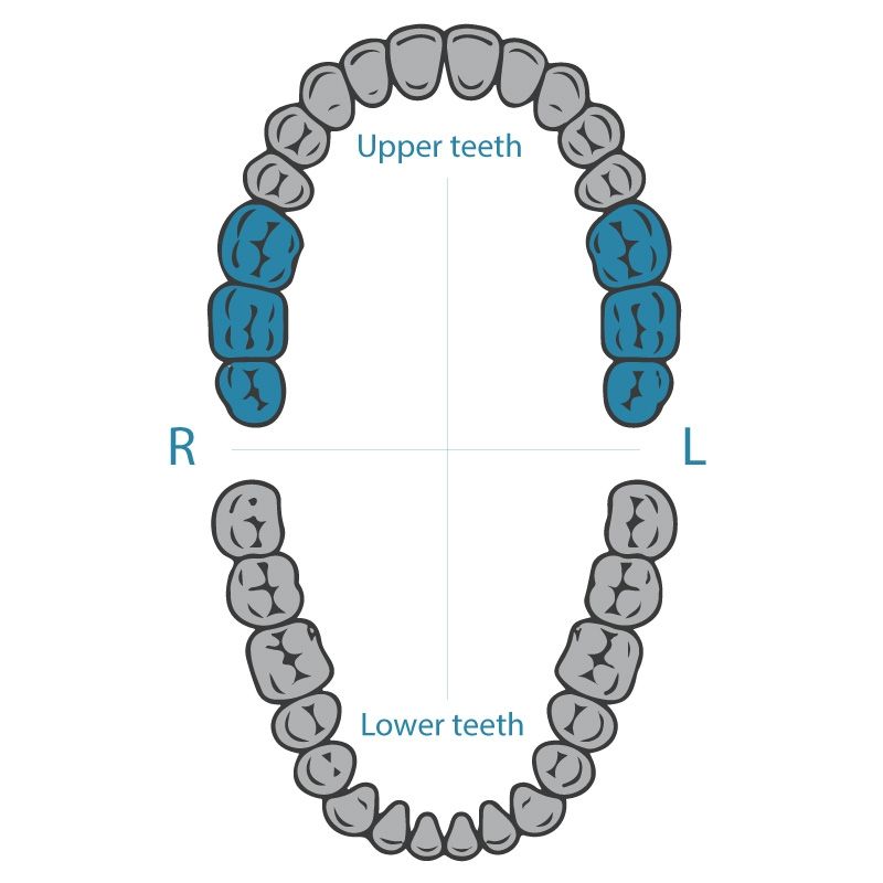 Dentech 201 rubber dam clamp for upper molars