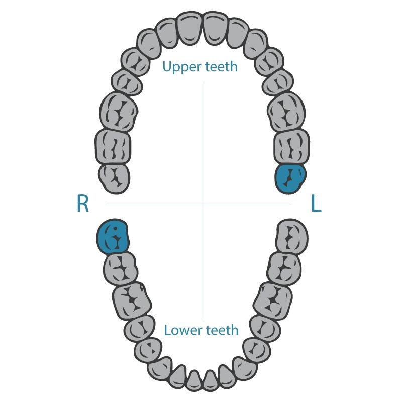 Dentech 139 rubber dam clamp for lower-right and upper-left molars