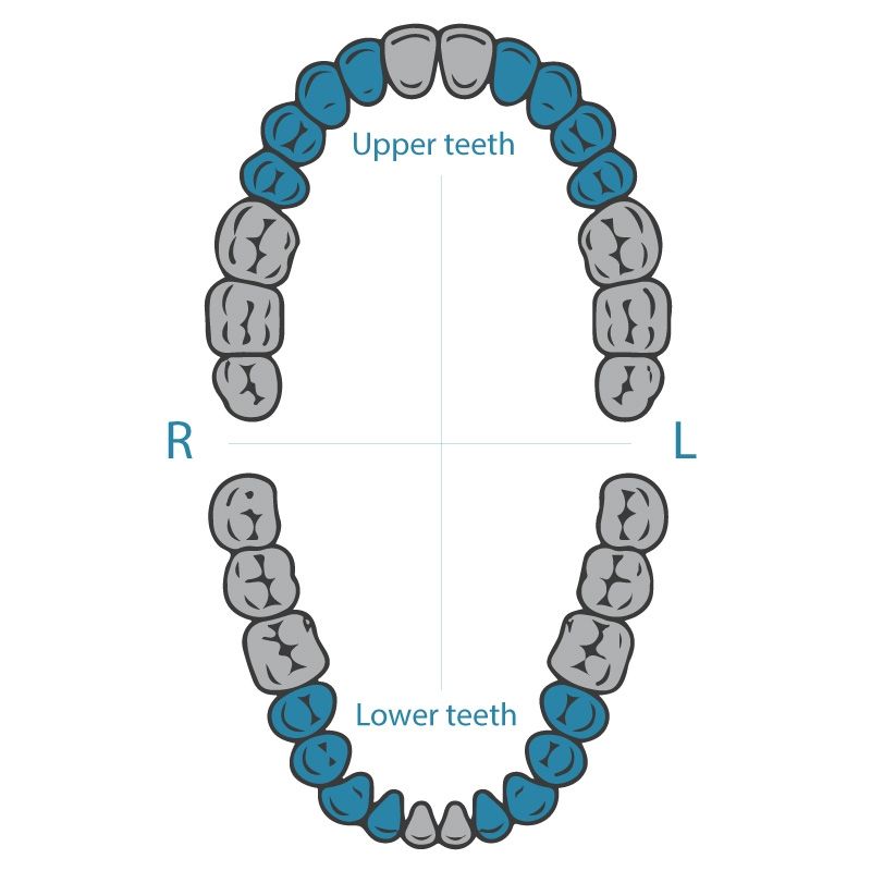 Dentech 0 rubber dam clamp for narrow premolars