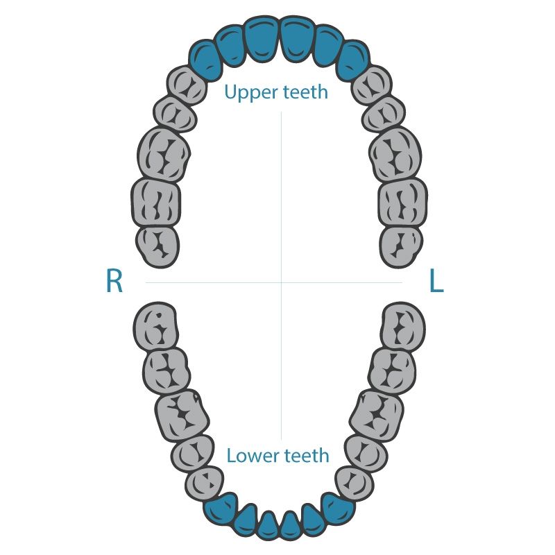 Dentech rubber dam clamp 6 for anterior teeth