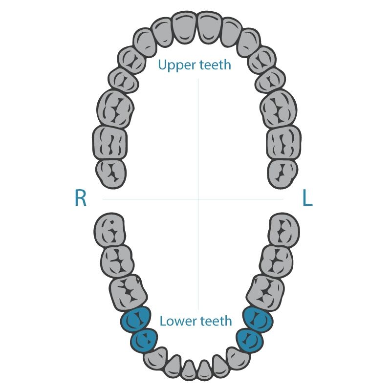 Dentech rubber dam clamp 2T for lower premolars