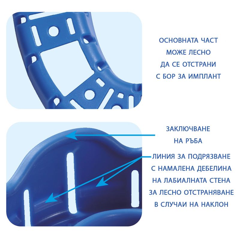 Premium Plus Disposable Impression Tray With Rim Lock upper M