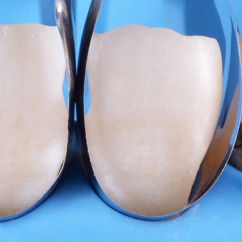 Polydentia Unica Anterior matrices, 12 pcs